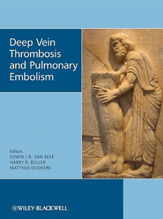 Carte Deep Vein Thrombosis and Pulmonary Embolism Edwin J. R. van Beek