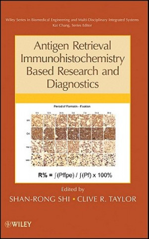 Carte Antigen Retrieval Immunohistochemistry Based Research and Diagnostics Shan-Rong Shi