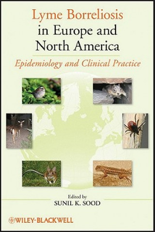 Könyv Lyme Borreliosis in Europe and North America - Epidemiology and Clinical Practice Sunil Kumar Sood