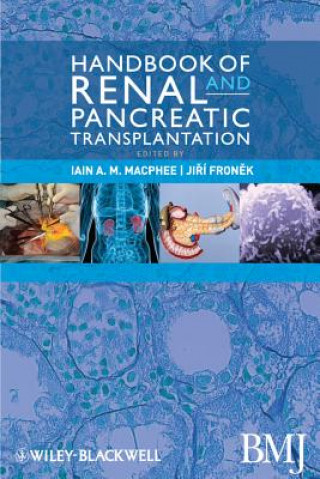 Carte Handbook of Renal and Pancreatic Transplantation Iain MacPhee