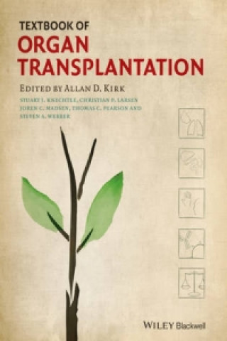 Carte Textbook of Organ Transplantation Allan D. Kirk