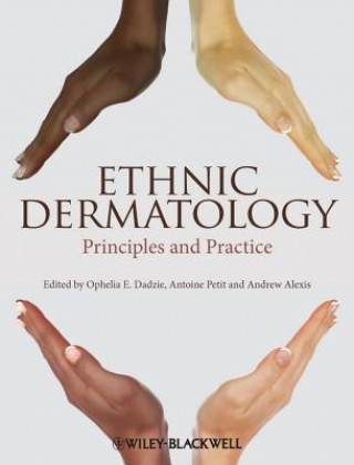 Kniha Ethnic Dermatology - Principles and Practice Ophelia E. Dadzie