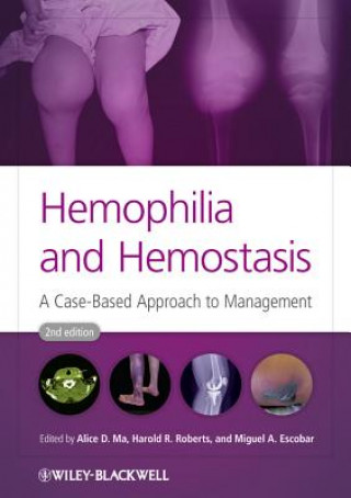Könyv Hemophilia and Hemostasis - A Case-Based Approach to Management 2e Alice D. Ma
