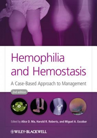 Książka Hemophilia and Hemostasis - A Case-Based Approach to Management 2e Alice D. Ma