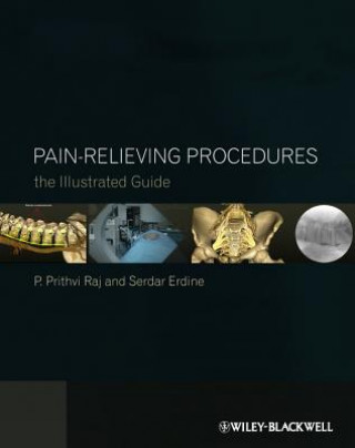 Carte Pain-Relieving Procedures - The Illustrated Guide P. Prithvi Raj