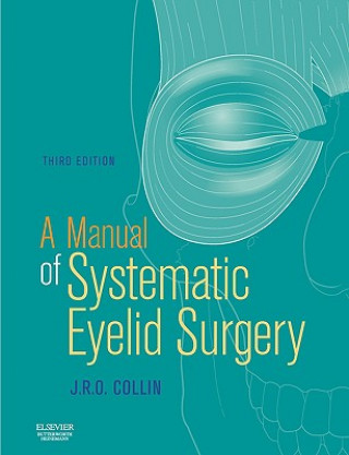 Kniha Manual of Systematic Eyelid Surgery J. R. O. Collin