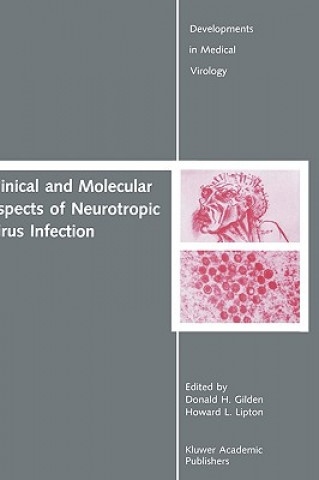 Carte Clinical and Molecular Aspects of Neurotropic Virus Infection Donald H. Gilden