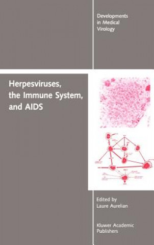 Knjiga Herpesviruses, the Immune System, and AIDS Yechiel Becker