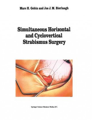 Książka Simultaneous Horizontal and Cyclovertical Strabismus Surgery M.H. Gobin