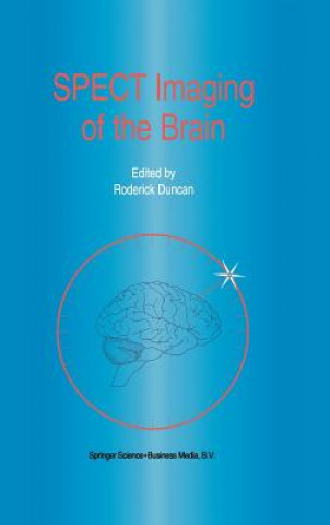 Kniha SPECT Imaging of the Brain R. Duncan