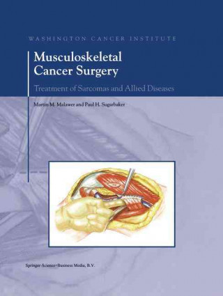 Livre Musculoskeletal Cancer Surgery Martin M. Malawer