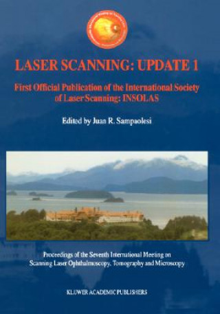 Carte Laser Scanning: Update 1 Juan R. Sampoalesi