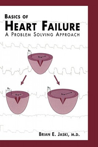 Carte Basics of Heart Failure Brian E. Jaski