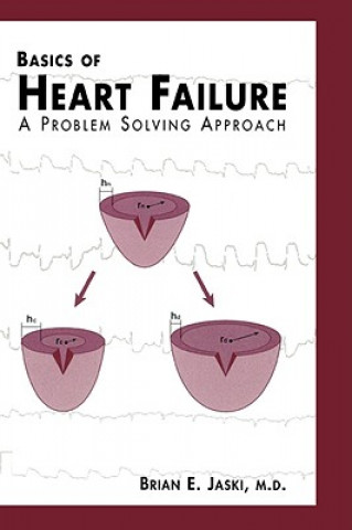 Книга Basics of Heart Failure Brian E. Jaski