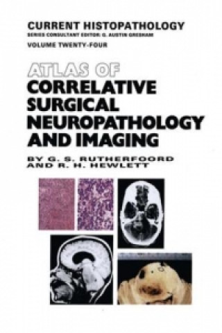 Carte Atlas of Correlative Surgical Neuropathology and Imaging G.S. Rutherfoord