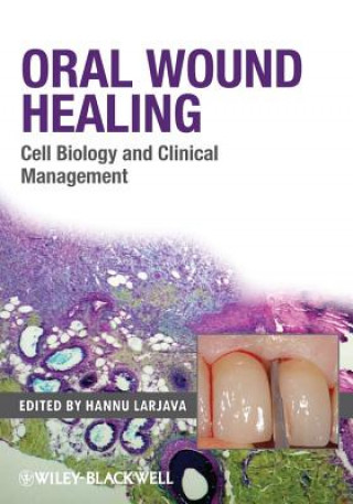 Könyv Oral Wound Healing - Cell Biology and Clinical Management Hannu Larjava