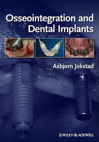 Kniha Osseointegration and Dental Implants Asbjorn Jokstad