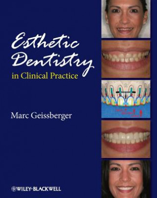 Carte Esthetic Dentistry in Clinical Practice Marc Geissberger
