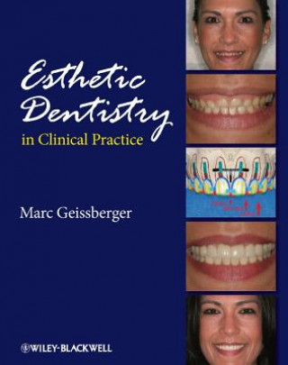 Book Esthetic Dentistry in Clinical Practice Marc Geissberger