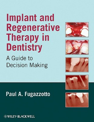 Libro Implant and Regenerative Therapy Paul A. Fugazzotto