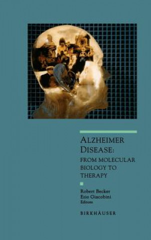Kniha Alzheimer Disease Robert Becker