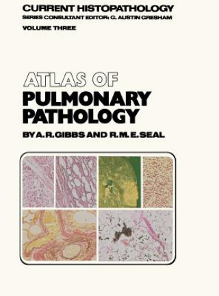 Kniha Atlas of Pulmonary Pathology Allen R. Gibbs