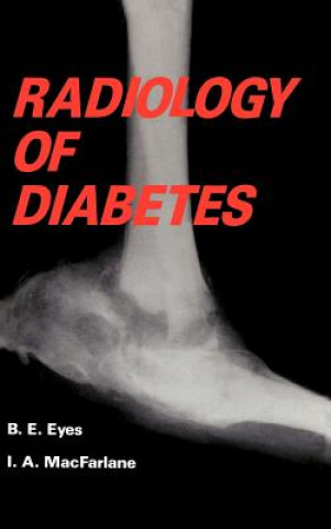 Kniha Radiology of Diabetes B. Eyes