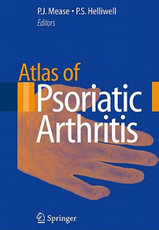 Carte Atlas of Psoriatic Arthritis Philip J. Mease