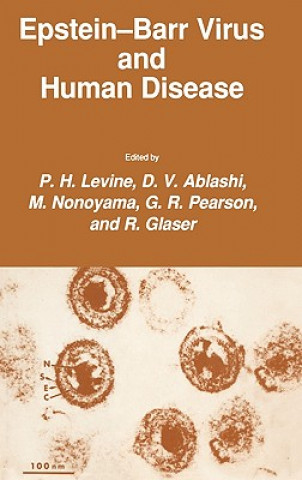 Carte Epstein-Barr Virus and Human Disease P. H. Levine