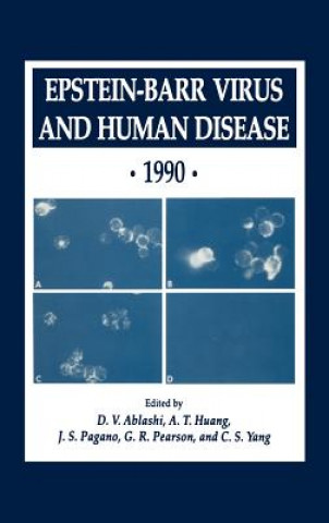 Livre Epstein-Barr Virus and Human Disease * 1990 D. V. Ablashi