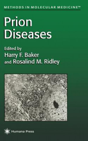 Książka Prion Diseases Harry F. Baker