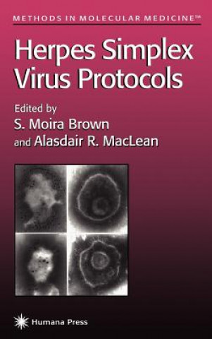 Książka Herpes Simplex Virus Protocols S. Moira Brown