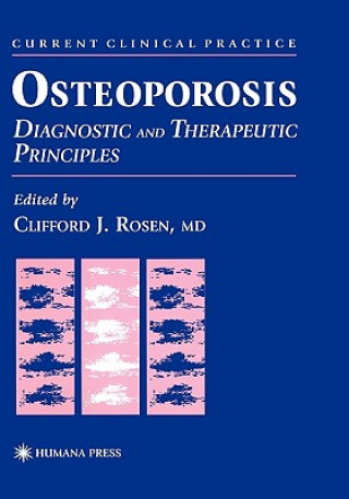Carte Osteoporosis Clifford J. Rosen