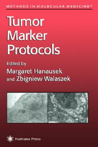 Buch Tumor Marker Protocols Margaret Hanausek