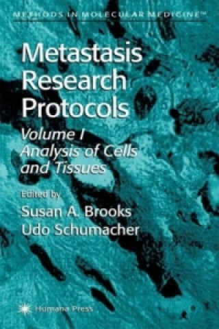 Knjiga Metastasis Research Protocols Susan A. Brooks