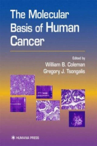 Carte The Molecular Basis of Human Cancer William B. Coleman