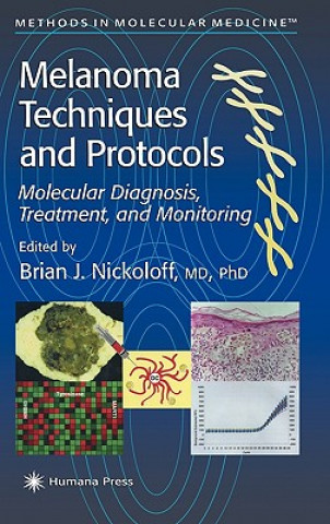 Book Melanoma Techniques and Protocols Brian J. Nickoloff