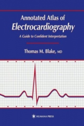 Könyv Annotated Atlas of Electrocardiography Thomas M. Blake
