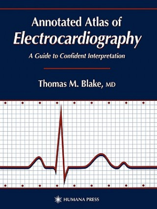 Könyv Annotated Atlas of Electrocardiography Thomas M. Blake