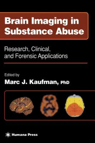 Könyv Brain Imaging in Substance Abuse Marc J. Kaufman