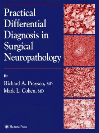 Kniha Practical Differential Diagnosis in Surgical Neuropathology Richard A. Prayson