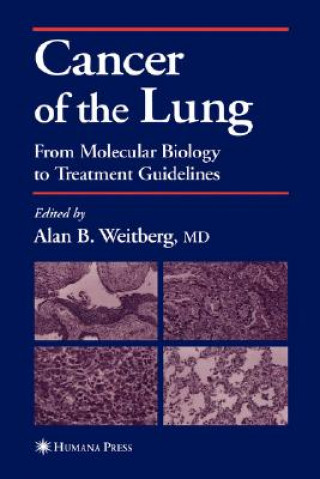 Könyv Cancer of the Lung Alan B. Weitberg