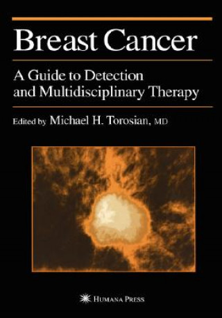 Boek Breast Cancer Michael H. Torosian