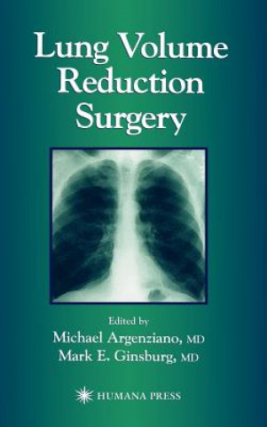 Carte Lung Volume Reduction Surgery Michael Argenziano