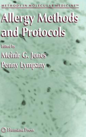 Carte Allergy Methods and Protocols M. G. Jones