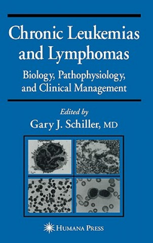 Kniha Chronic Leukemias and Lymphomas Gary J. Schiller