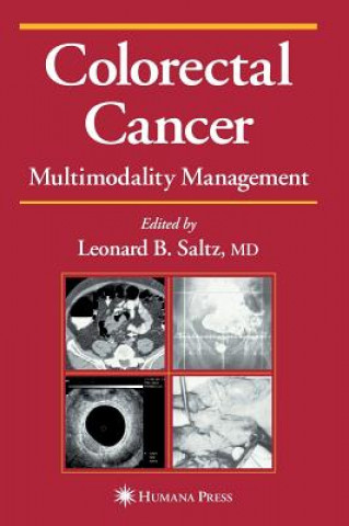 Kniha Colorectal Cancer Leonard B. Saltz