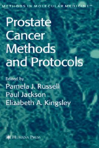 Carte Prostate Cancer Methods and Protocols Pamela J. Russell