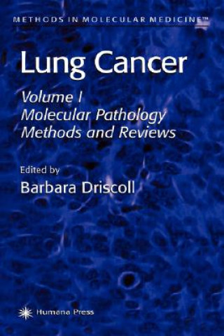 Carte Lung Cancer Barbara Driscoll