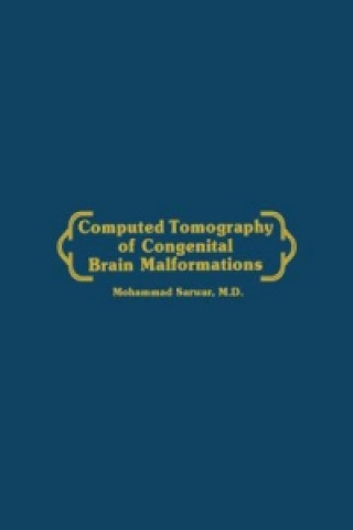 Carte Computed Tomography of Congenital Brain Malformations Mohammed Sarwar